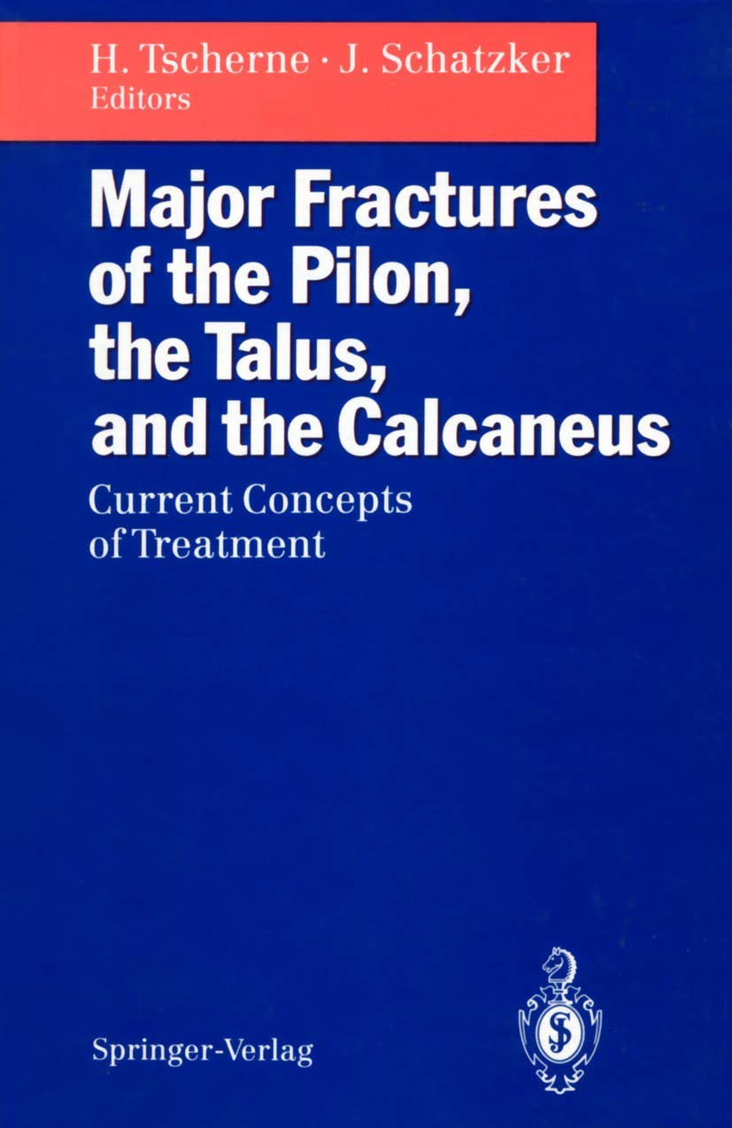 Major Fractures of the Pilon, the Talus, and the Calcaneus: Current Concepts of Treatment,Used