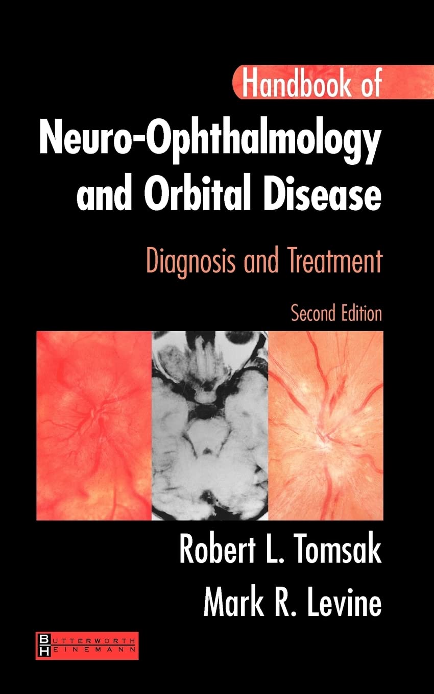 Handbook of NeuroOphthalmology: Diagnosis & Treatment,Used