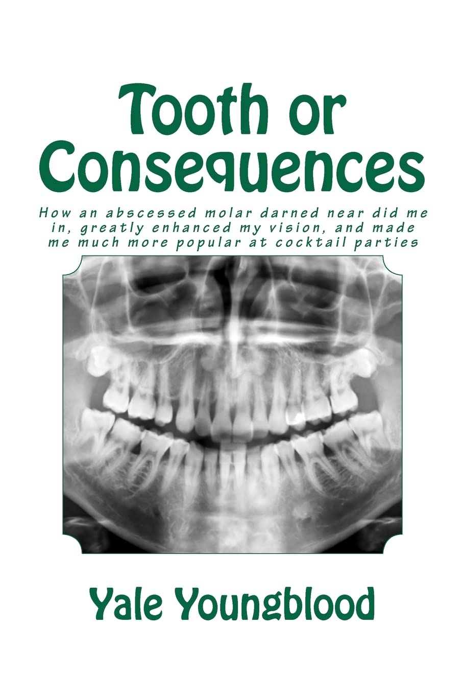 Tooth Or Consequences: How An Abscessed Molar Darned Near Did Me In, Greatly Enhanced My Vision, And Made Me Much More Popular A,Used