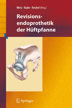 Revisionsendoprothetik der Hftpfanne (German Edition),Used