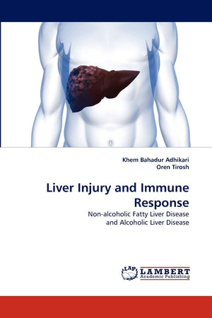 Liver Injury and Immune Response: Nonalcoholic Fatty Liver Disease and Alcoholic Liver Disease,Used