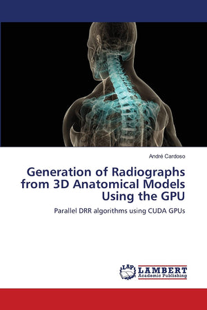 Generation of Radiographs from 3D Anatomical Models Using the GPU: Parallel DRR algorithms using CUDA GPUs,Used