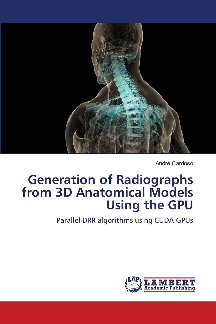 Generation of Radiographs from 3D Anatomical Models Using the GPU: Parallel DRR algorithms using CUDA GPUs,Used