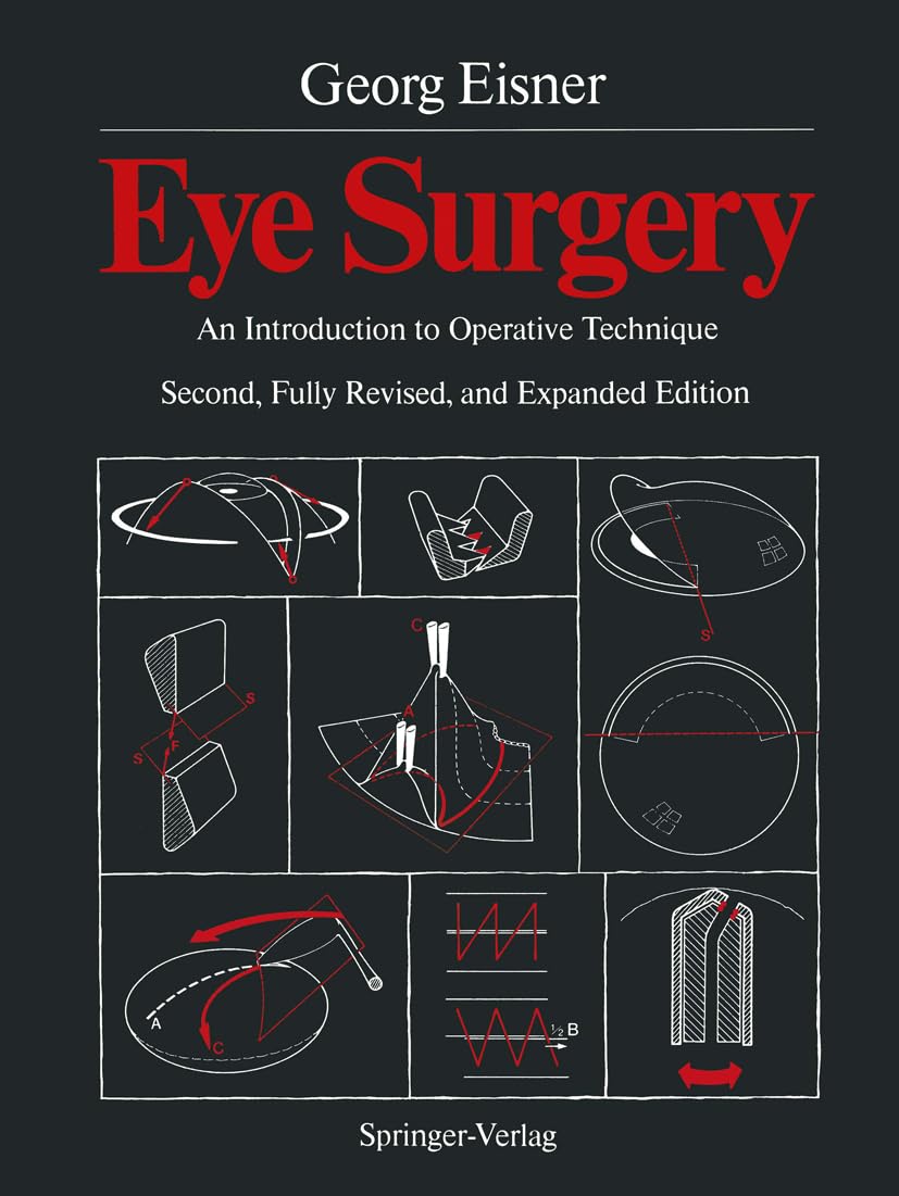 Eye Surgery: An Introduction To Operative Technique