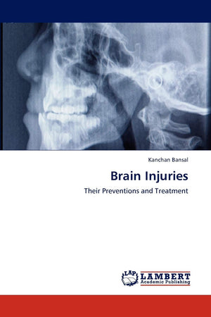 Brain Injuries: Their Preventions and Treatment,Used