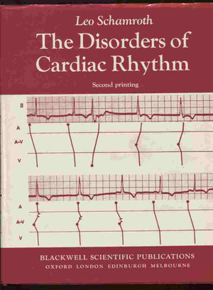 The Disorders Of Cardiac Rhythm