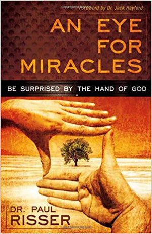 An Eye For Miracles: Be Surprised By The Hand Of God