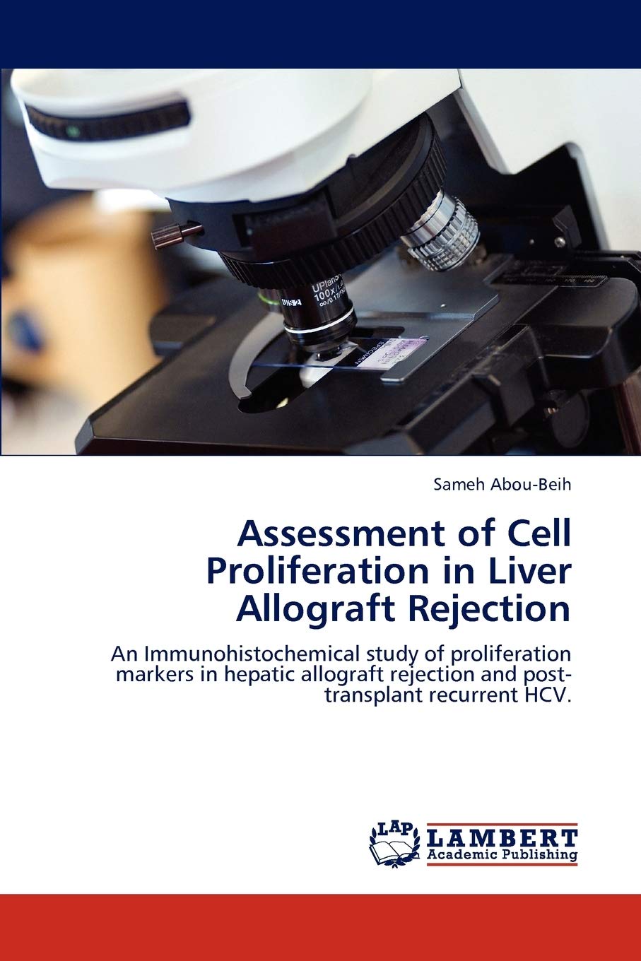Assessment of Cell Proliferation in Liver Allograft Rejection: An Immunohistochemical study of proliferation markers in hepatic ,Used