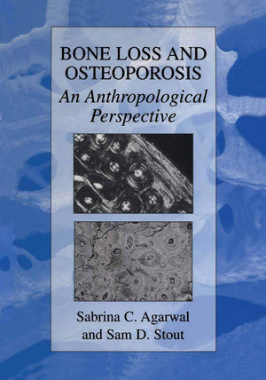 Bone Loss and Osteoporosis: An Anthropological Perspective,New