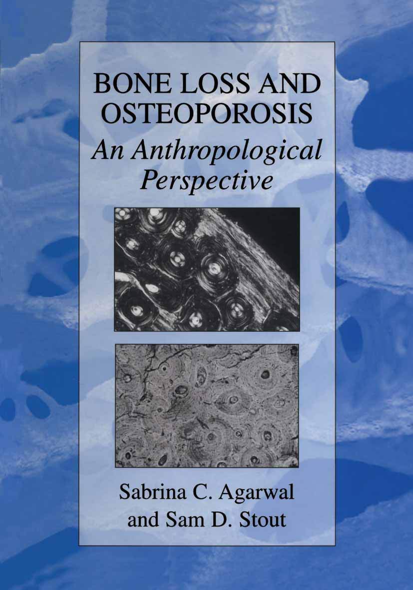 Bone Loss and Osteoporosis: An Anthropological Perspective,New