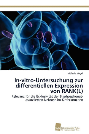 InvitroUntersuchung zur differentiellen Expression von RANK(L): Relevanz fr die Exklusivitt der Bisphosphonatassoziierten Nek,Used