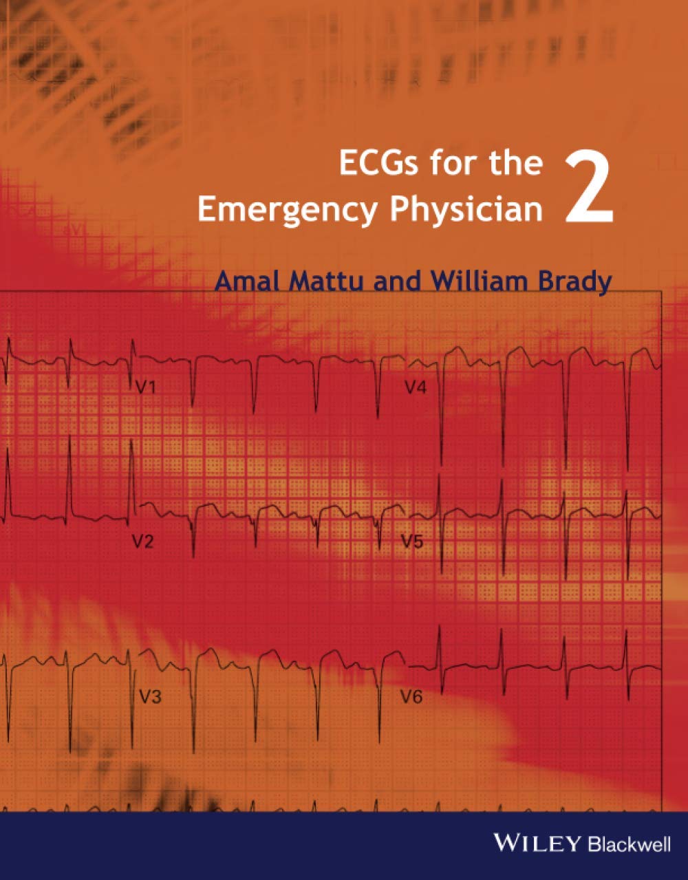 Ecgs For The Emergency Physician 2