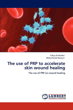 The use of PRP to accelerate skin wound healing: The use of PRP on wound healing,Used