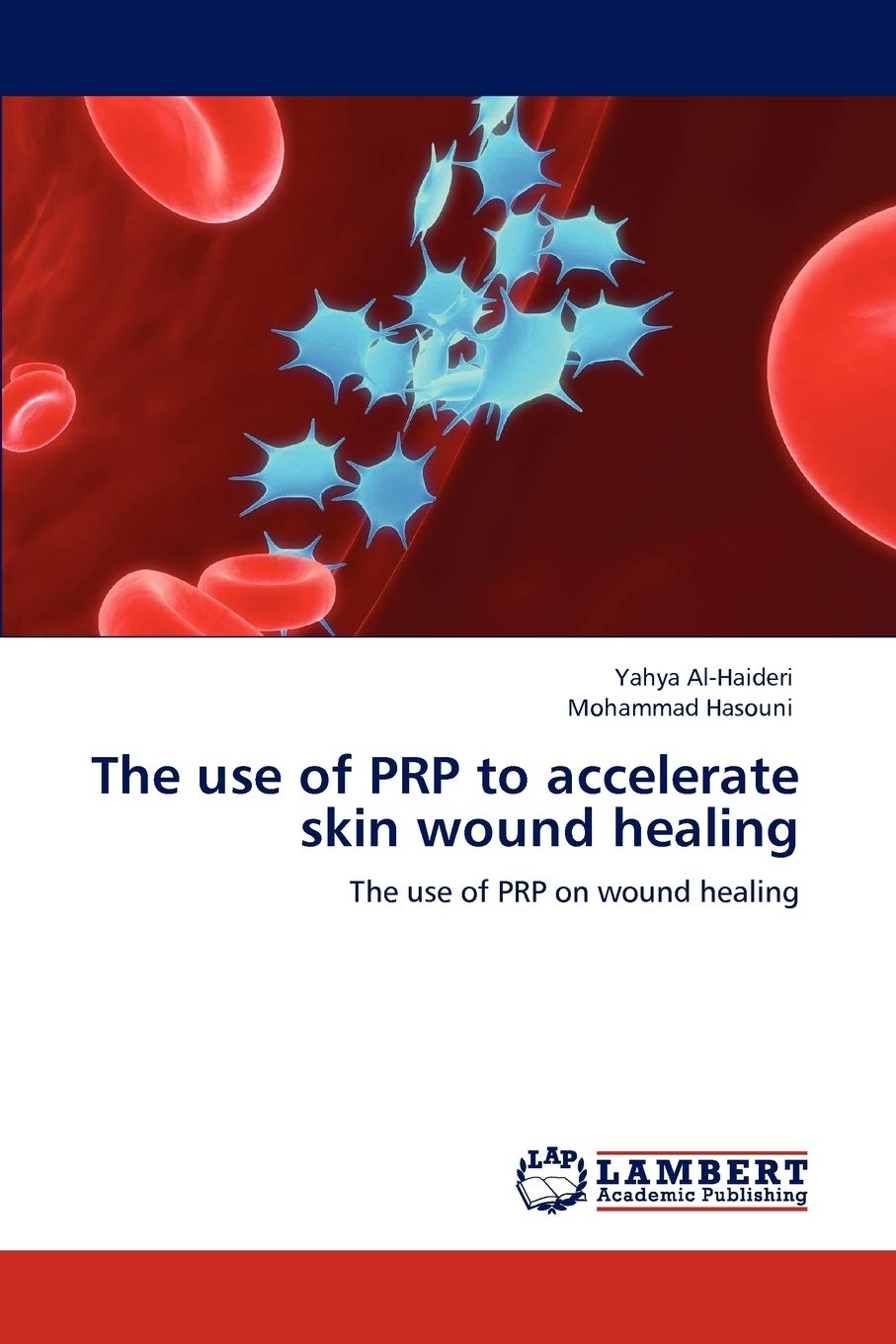 The use of PRP to accelerate skin wound healing: The use of PRP on wound healing,Used