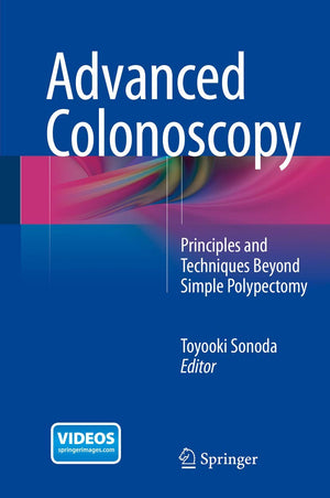 Advanced Colonoscopy: Principles and Techniques Beyond Simple Polypectomy,Used