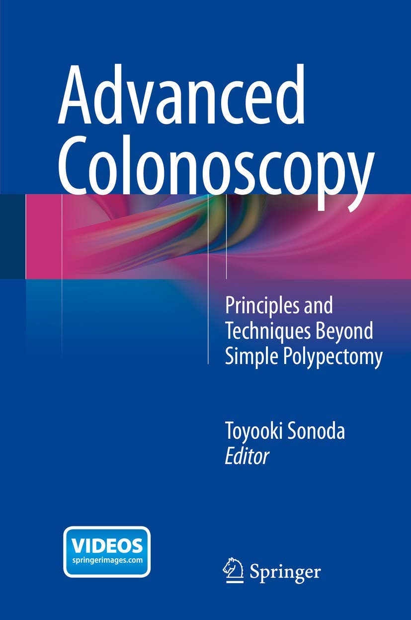 Advanced Colonoscopy: Principles and Techniques Beyond Simple Polypectomy,Used