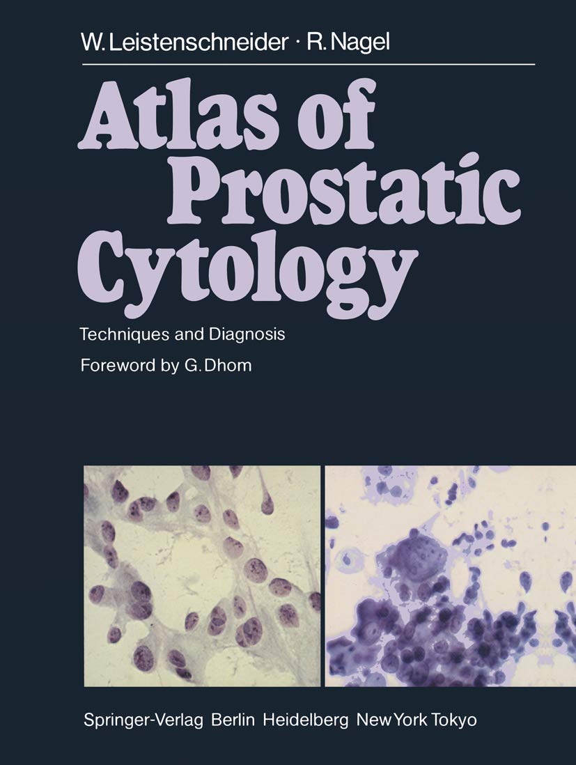 Atlas Of Prostatic Cytology: Techniques And Diagnosis,Used