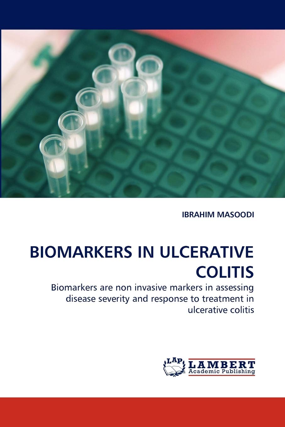 BIOMARKERS IN ULCERATIVE COLITIS: Biomarkers are non invasive markers in assessing disease severity and response to treatment in,Used