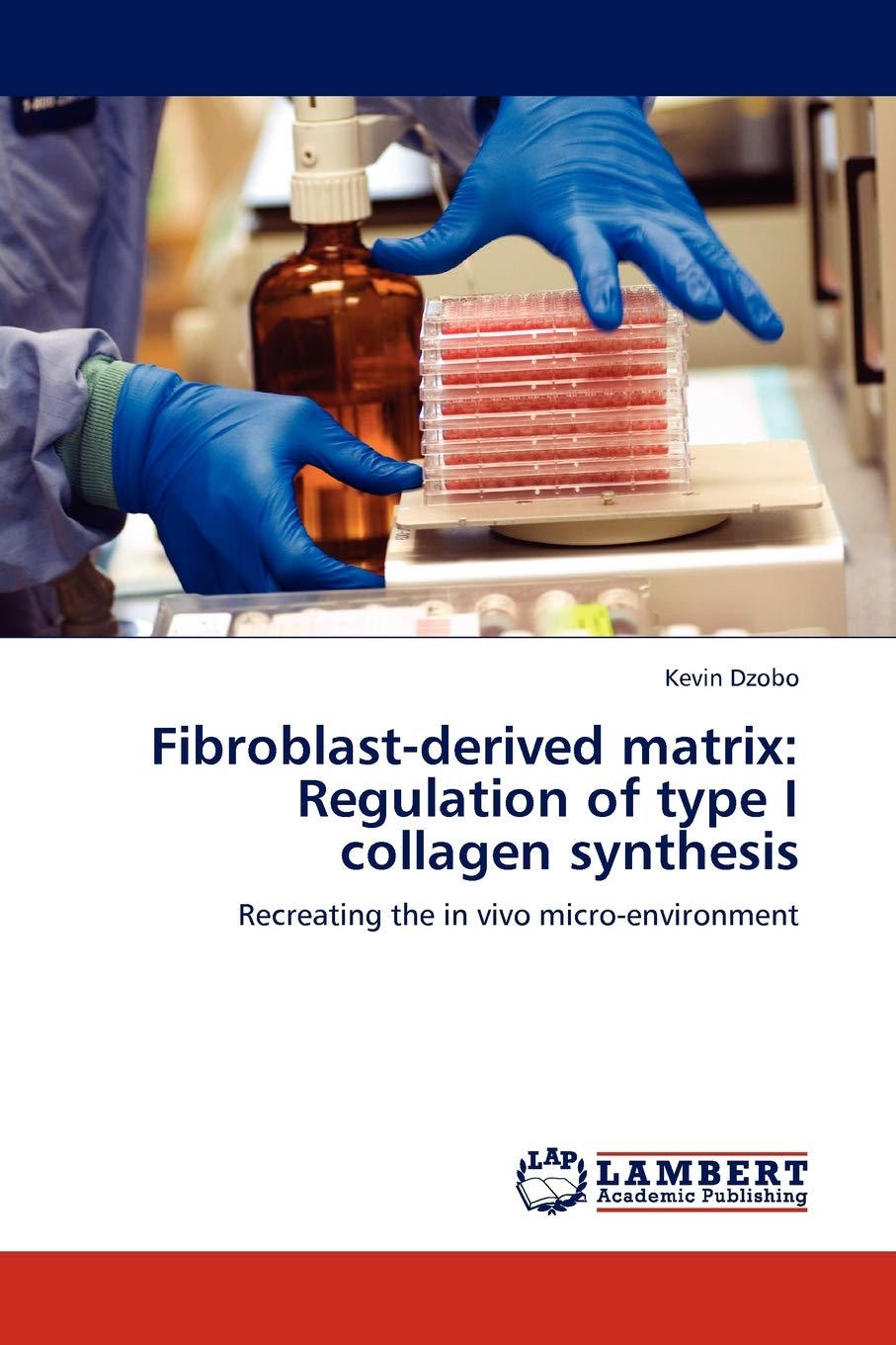 Fibroblastderived matrix: Regulation of type I collagen synthesis: Recreating the in vivo microenvironment,Used