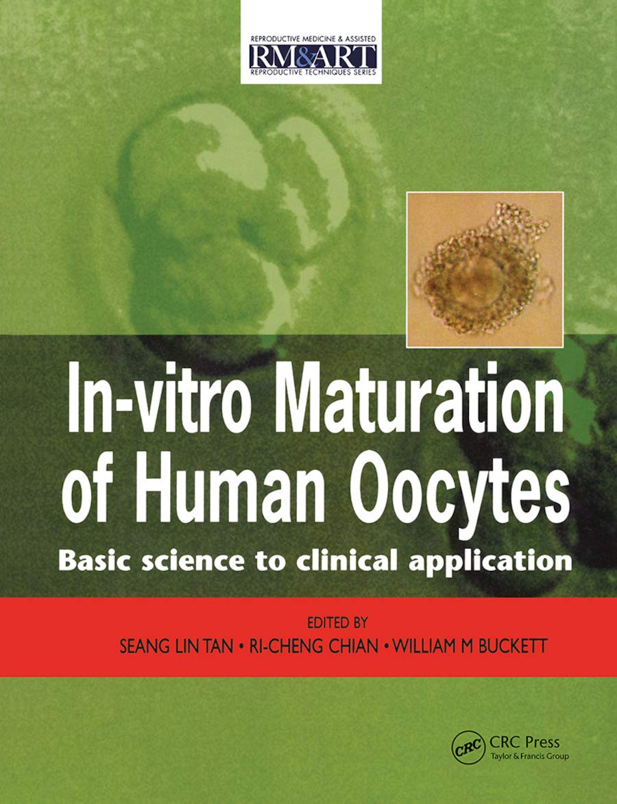 In Vitro Maturation of Human Oocytes,Used