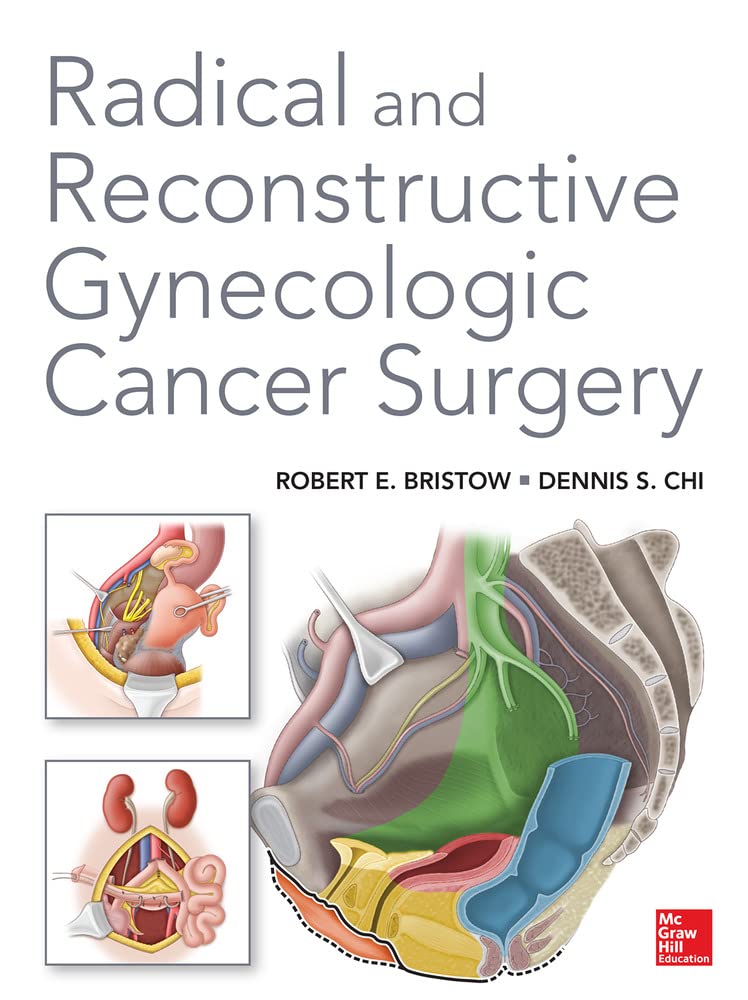 Radical and Reconstructive Gynecologic Cancer Surgery,Used