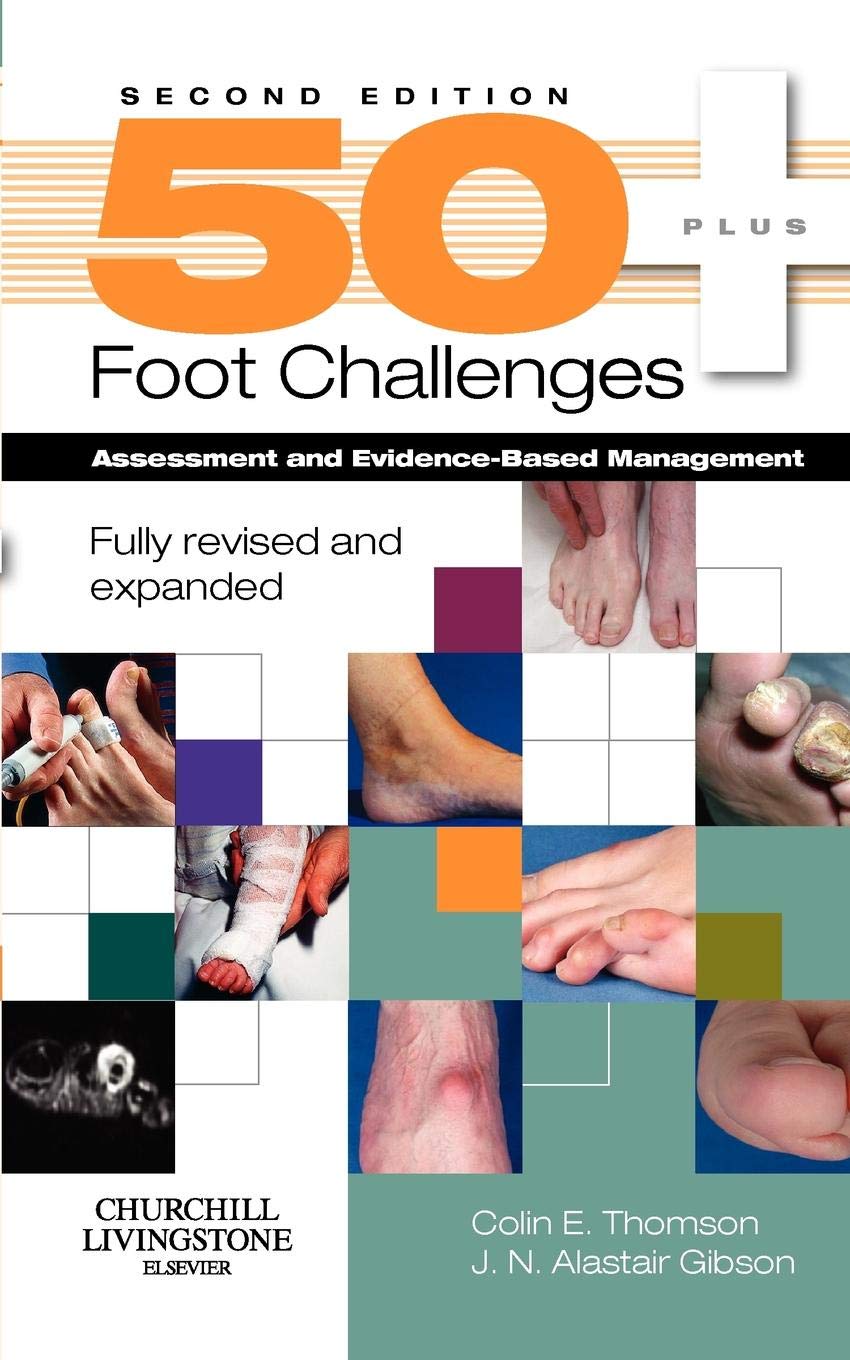 50+ Foot Challenges: Assessment and EvidenceBased Management,Used