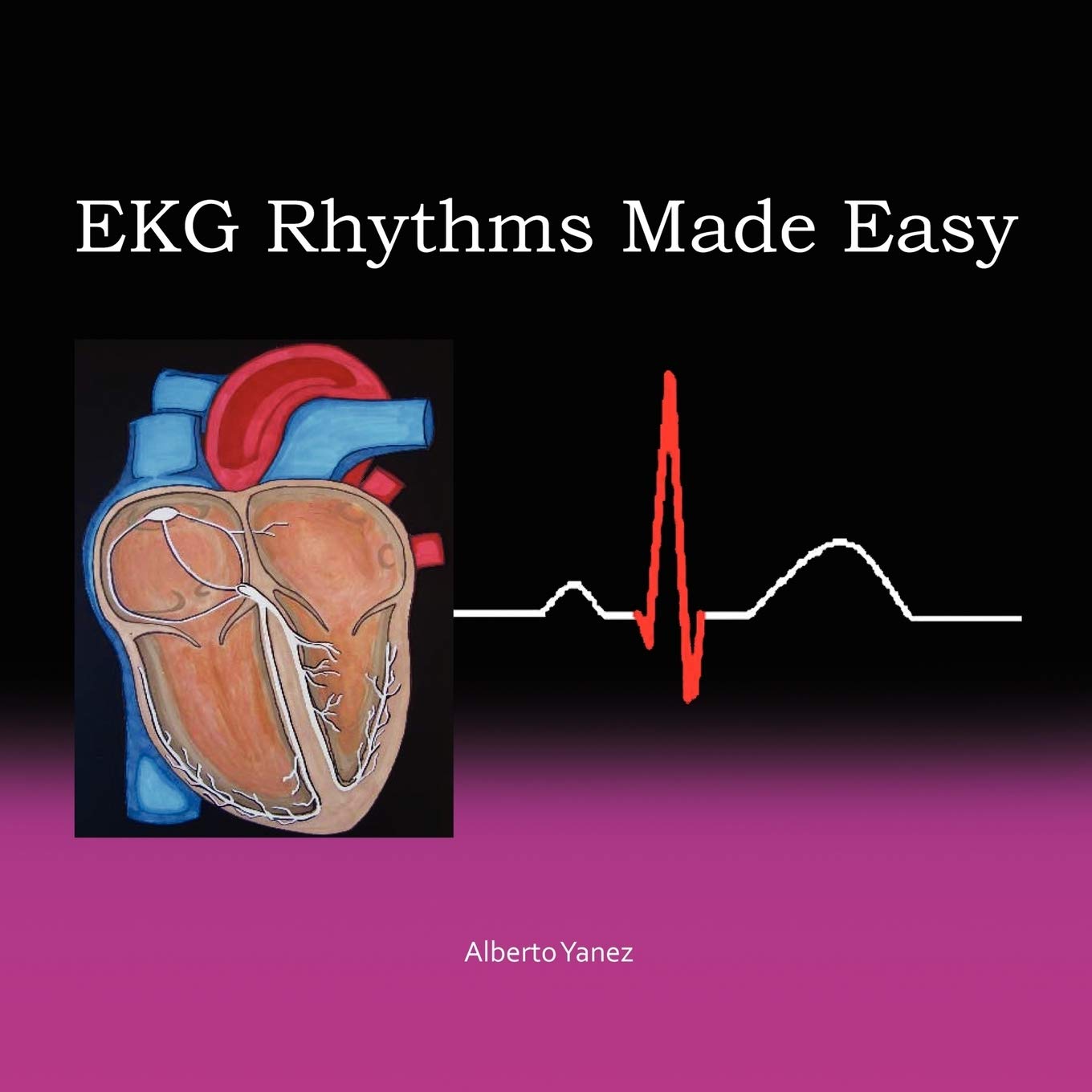 EKG Rhythms Made Easy,Used