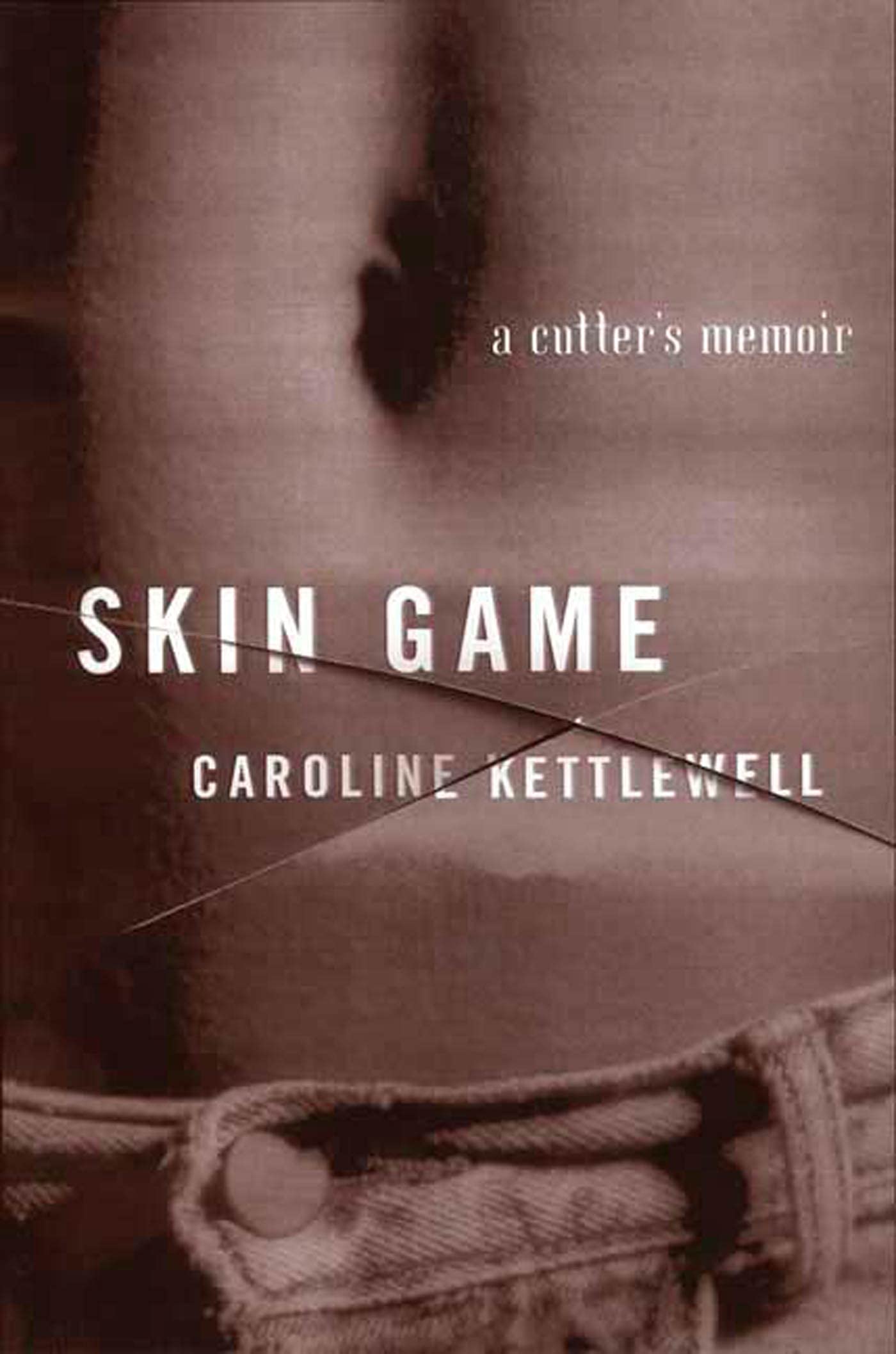 Skin Game: A Memoir,Used
