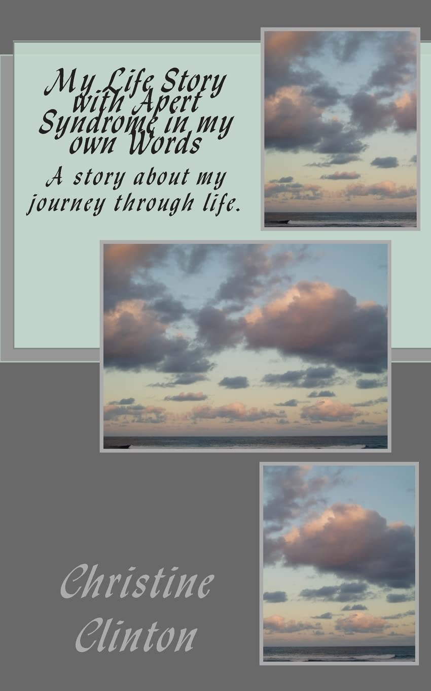 My Life Story With Apert Syndrome In My Own Words,Used