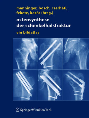 Osteosynthese der Schenkelhalsfraktur: Ein Bildatlas (German Edition),Used