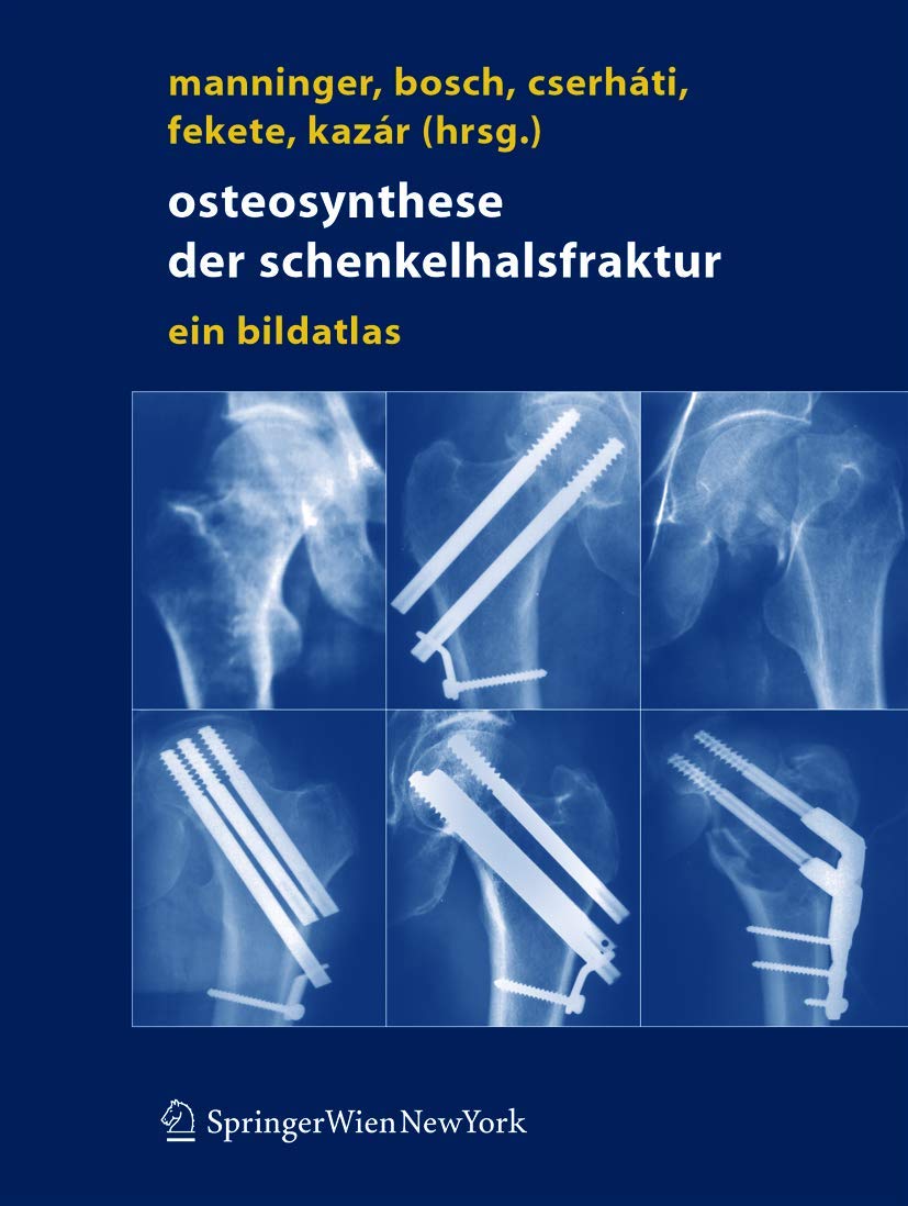 Osteosynthese der Schenkelhalsfraktur: Ein Bildatlas (German Edition),Used
