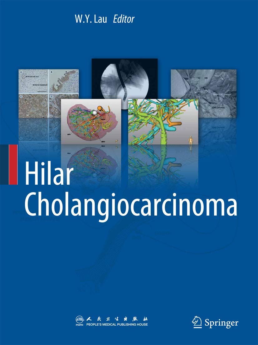 Hilar Cholangiocarcinoma,Used