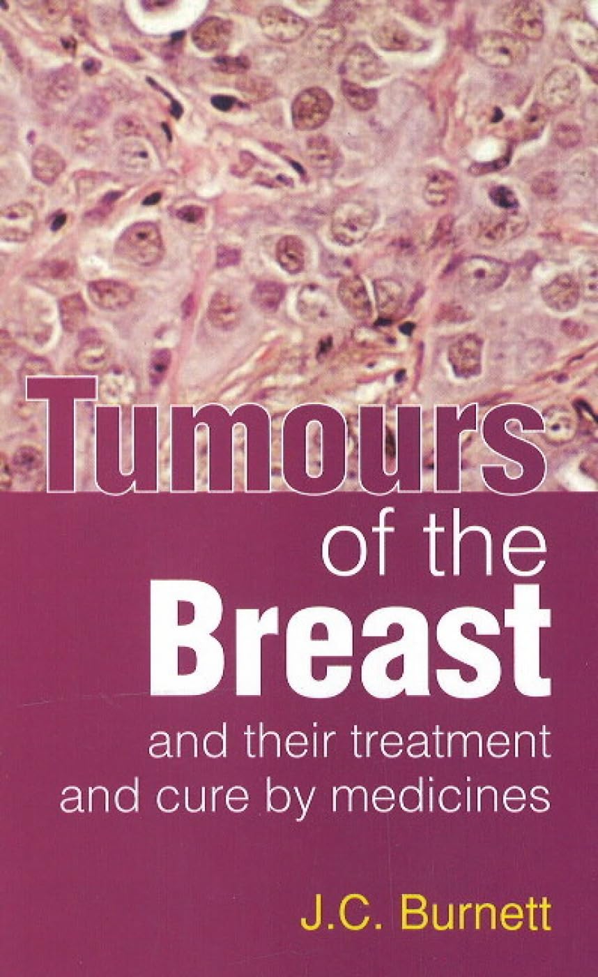 Tumours Of The Breast - Their Treatment And Cure By Medicines
