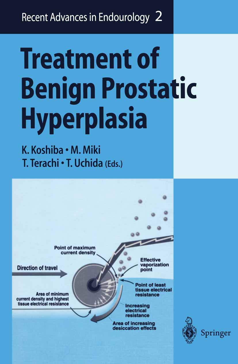 Treatment of Benign Prostatic Hyperplasia (Recent Advances in Endourology, 2),Used