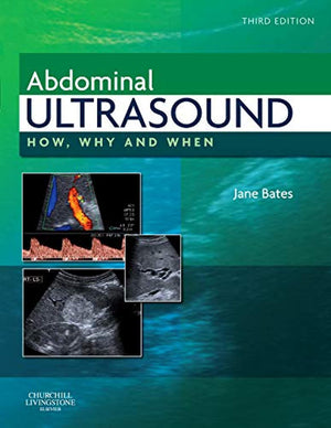 Abdominal Ultrasound: How, Why And When