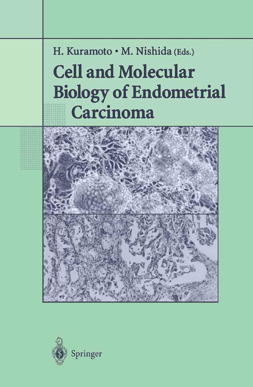Cell and Molecular Biology of Endometrial Carcinoma,Used