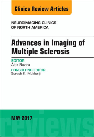 Advances in Imaging of Multiple Sclerosis, An Issue of Neuroimaging Clinics of North America (Volume 272) (The Clinics: Radiolo,Used