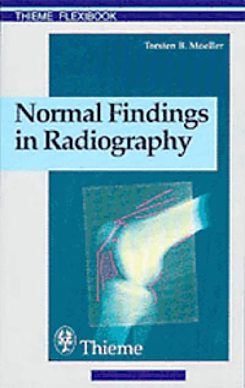 Normal Findings in Radiography (Thieme Flexibook),New
