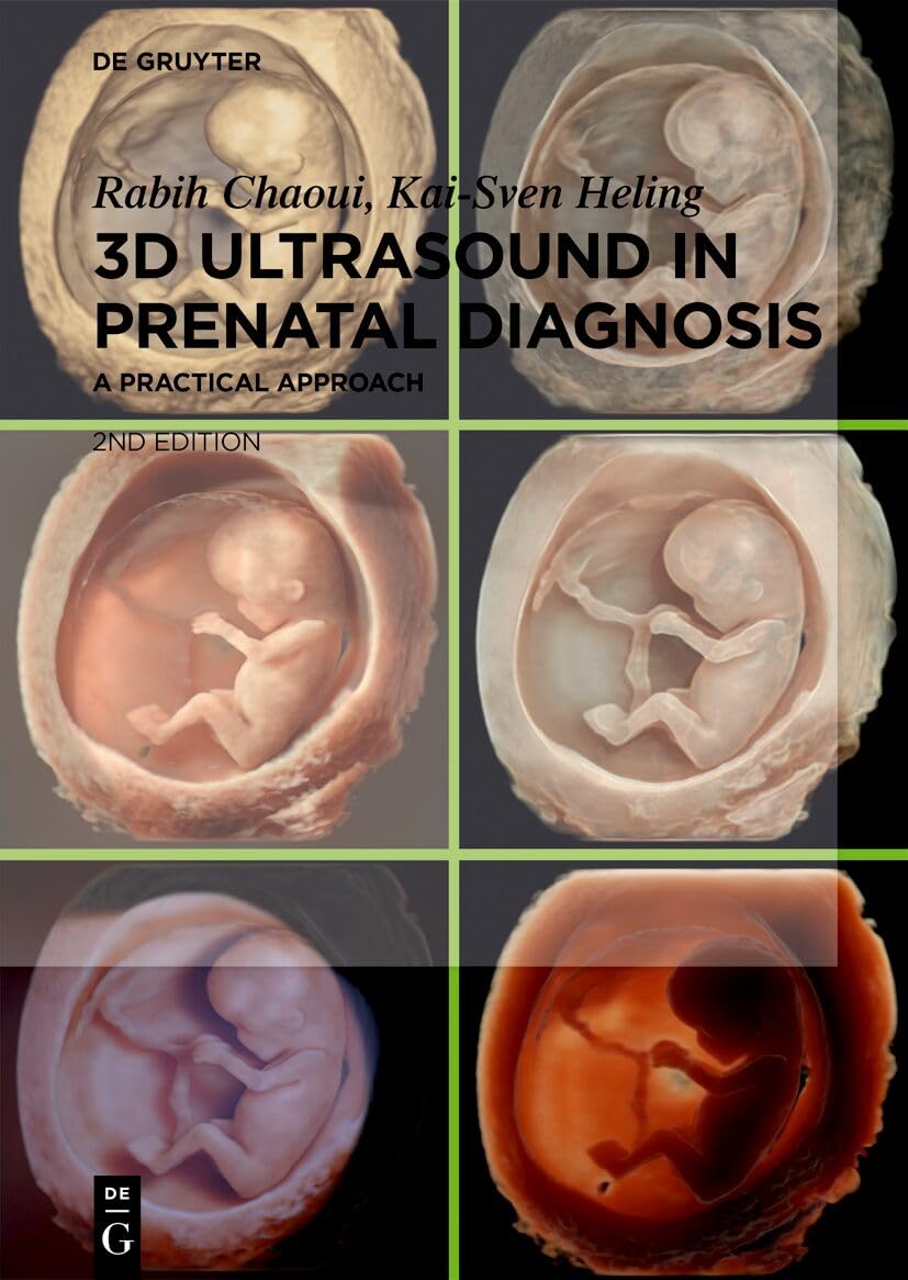 3D Ultrasound in Prenatal Diagnosis: A Practical Approach,New