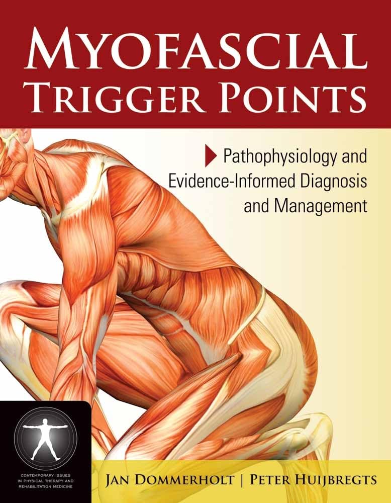 Myofascial Trigger Points: Pathophysiology And Evidenceinformed Diagnosis And Management: Pathophysiology And Evidenceinformed