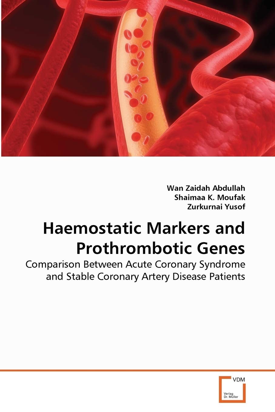 Haemostatic Markers and Prothrombotic Genes: Comparison Between Acute Coronary Syndrome and Stable Coronary Artery Disease Patie,Used