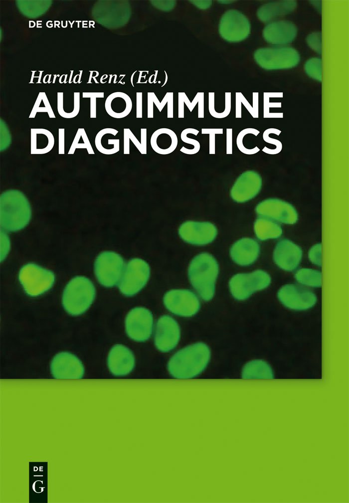 Autoimmune Diagnostics,Used