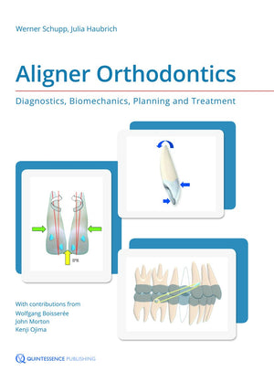 Aligner Orthodontics: Diagnostics, Biomechanics, Planning And Treatment