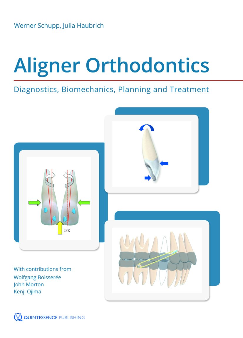 Aligner Orthodontics: Diagnostics, Biomechanics, Planning And Treatment