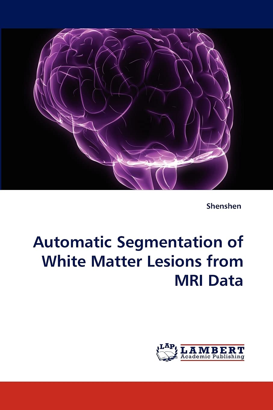 Automatic Segmentation of White Matter Lesions from MRI Data,Used
