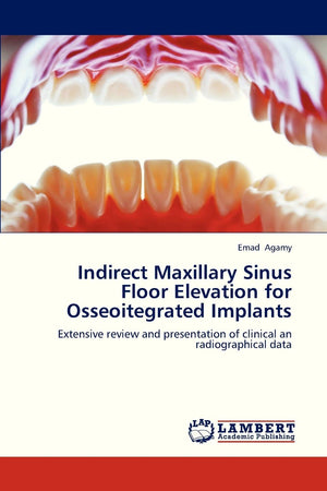 Indirect Maxillary Sinus Floor Elevation for Osseoitegrated Implants: Extensive review and presentation of clinical an radiograp,Used