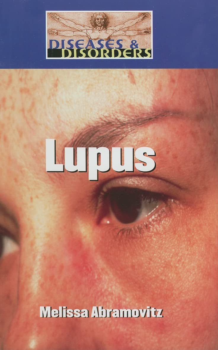 Lupus (Diseases and Disorders),New