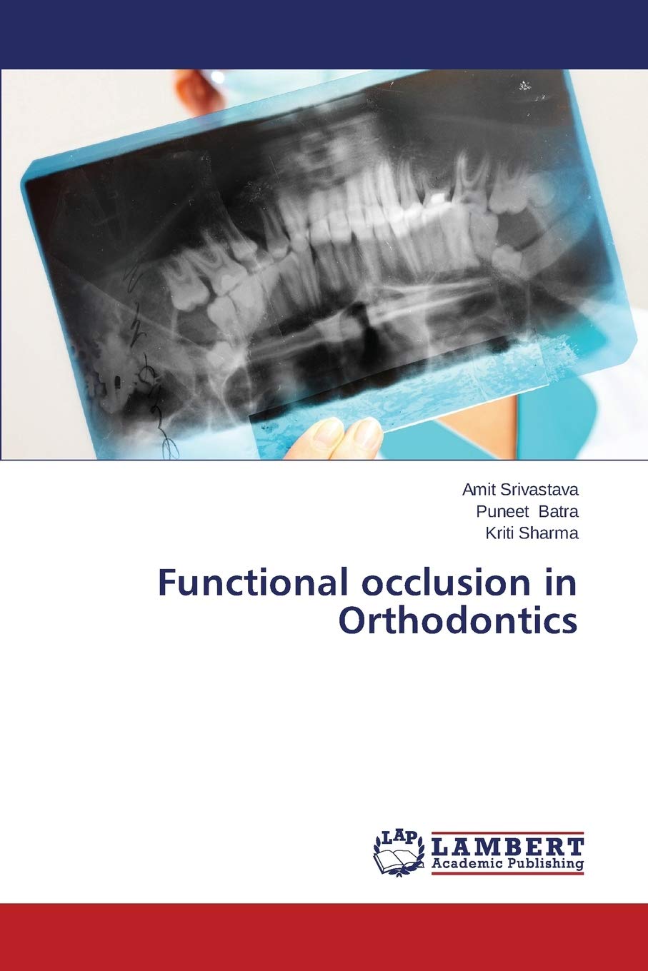 Functional occlusion in Orthodontics,Used