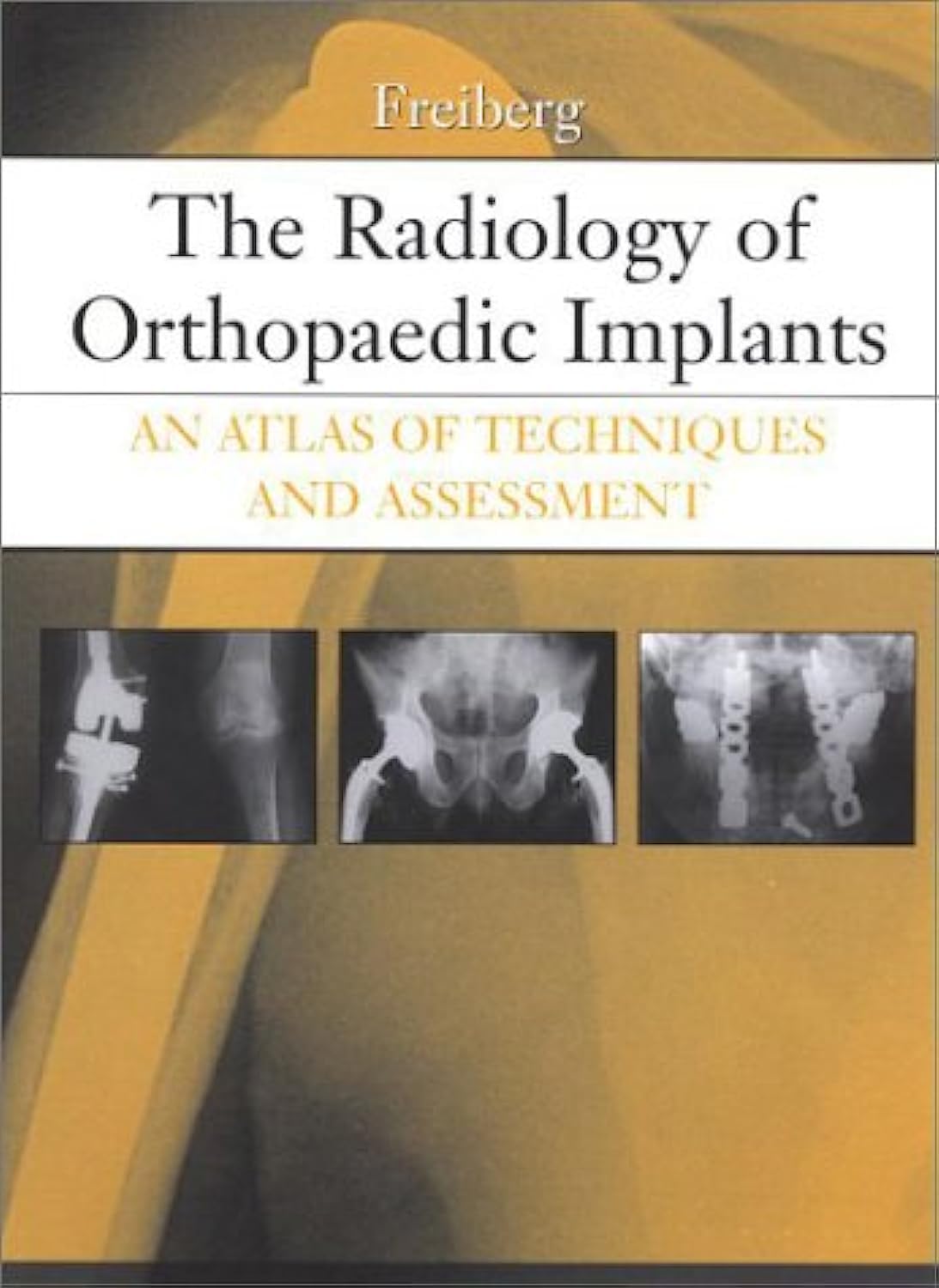 The Radiology of Orthopaedic Implants: An Atlas of Techniques and Assessment