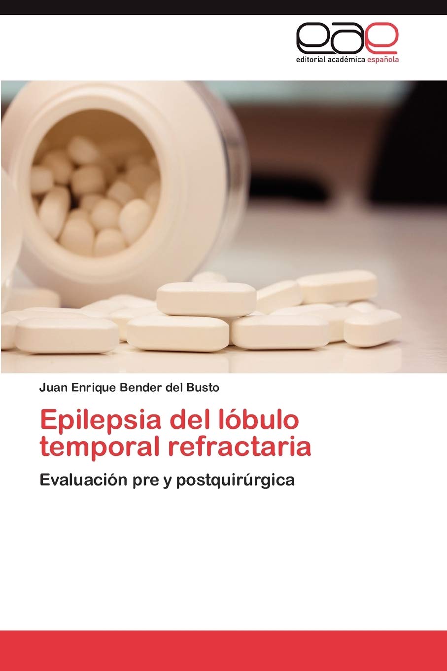 Epilepsia del lbulo temporal refractaria: Evaluacin pre y postquirrgica (Spanish Edition),Used
